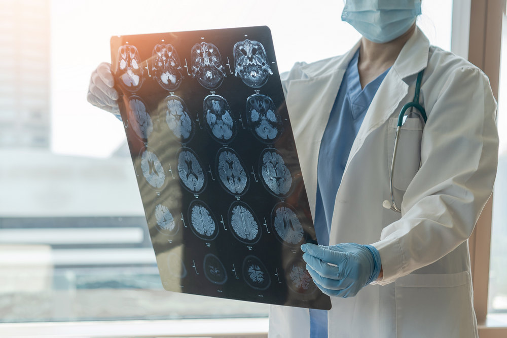 Brain,Disease,Diagnosis,With,Medical,Doctor,Seeing,Magnetic,Resonance,Imaging